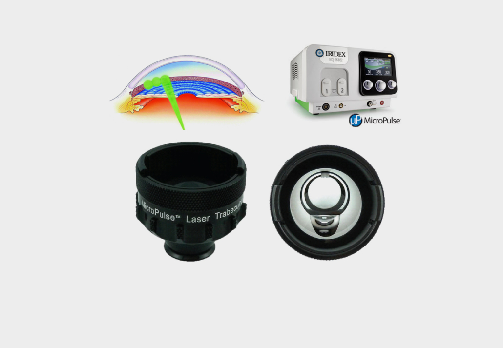 laser_giallo_iridex_oculista_torchia_9